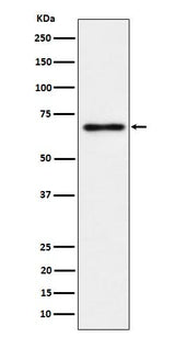 Anti-NR2C2 / TR4 Rabbit Monoclonal Antibody Boster Bio