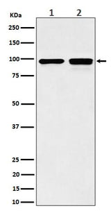 Anti-MCM6 Rabbit Monoclonal Antibody Boster Bio