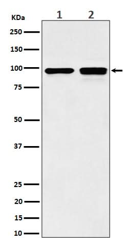 Anti-MCM6 Rabbit Monoclonal Antibody Boster Bio