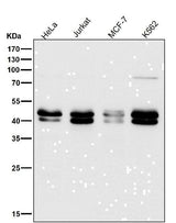 Anti-TIA1 Rabbit Monoclonal Antibody Boster Bio