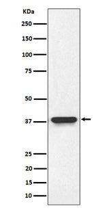 Anti-NMI Rabbit Monoclonal Antibody Boster Bio