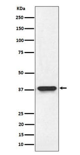 Anti-NMI Rabbit Monoclonal Antibody Boster Bio