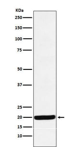 Anti-Y14 Rabbit Monoclonal Antibody Boster Bio