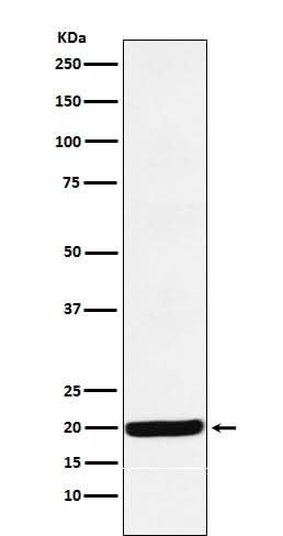Anti-Y14 Rabbit Monoclonal Antibody Boster Bio
