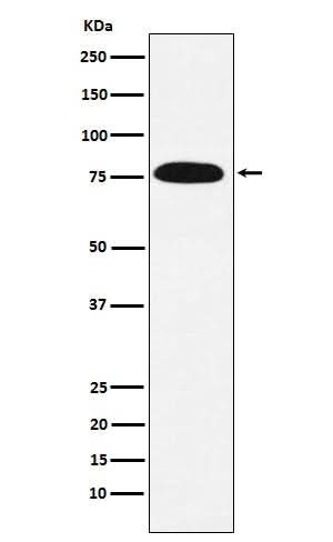 Anti-KHSRP Rabbit Monoclonal Antibody Boster Bio