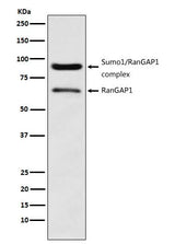 Anti-RanGAP1 Rabbit Monoclonal Antibody Boster Bio