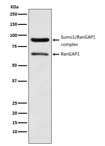 Anti-RanGAP1 Rabbit Monoclonal Antibody Boster Bio