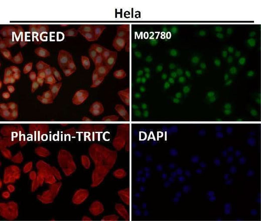 Anti-HP1 alpha CBX5 Rabbit Monoclonal Antibody Boster Bio