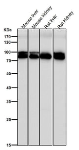 Anti-Aconitase 1 ACO1 Rabbit Monoclonal Antibody Boster Bio