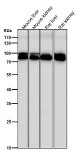 Anti-Aconitase 1 ACO1 Rabbit Monoclonal Antibody Boster Bio