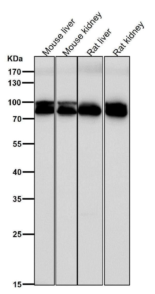 Anti-Aconitase 1 ACO1 Rabbit Monoclonal Antibody Boster Bio