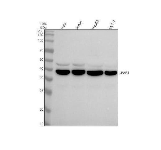 Anti-EDG2 LPAR1 Rabbit Monoclonal Antibody Boster Bio