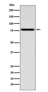 Anti-Coilin Rabbit Monoclonal Antibody Boster Bio