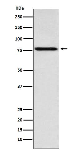 Anti-Coilin Rabbit Monoclonal Antibody Boster Bio