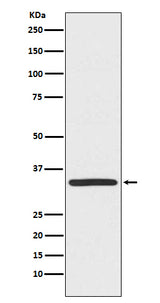 Anti-TRADD Monoclonal Antibody Boster Bio