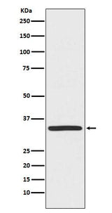 Anti-TRADD Monoclonal Antibody Boster Bio