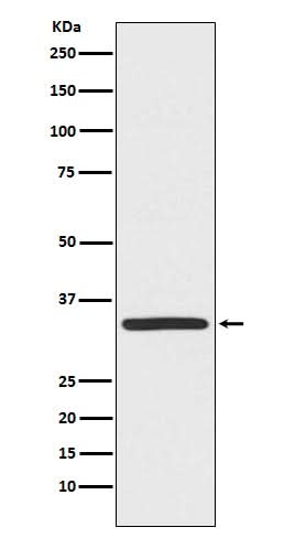 Anti-TRADD Monoclonal Antibody Boster Bio