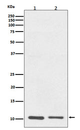 Anti-S100A10 Rabbit Monoclonal Antibody Boster Bio
