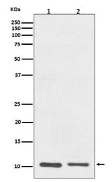 Anti-S100A10 Rabbit Monoclonal Antibody Boster Bio