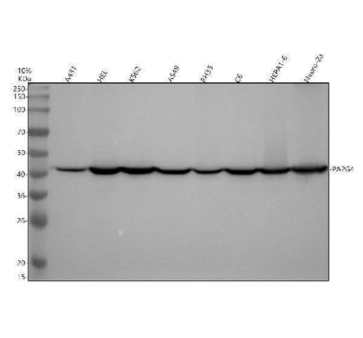 Anti-EBP1 / PA2G4 Rabbit Monoclonal Antibody Boster Bio