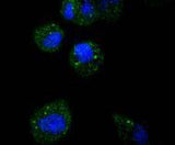 Anti-ATF5 Rabbit Monoclonal Antibody Boster Bio