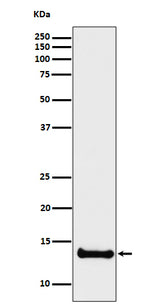 Anti-Cystatin B Rabbit Monoclonal Antibody Boster Bio
