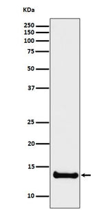 Anti-Cystatin B Rabbit Monoclonal Antibody Boster Bio