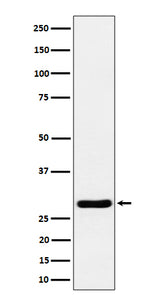 Anti-Calcipressin 1 Rabbit Monoclonal Antibody Boster Bio