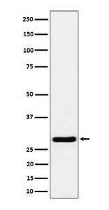 Anti-Calcipressin 1 Rabbit Monoclonal Antibody Boster Bio