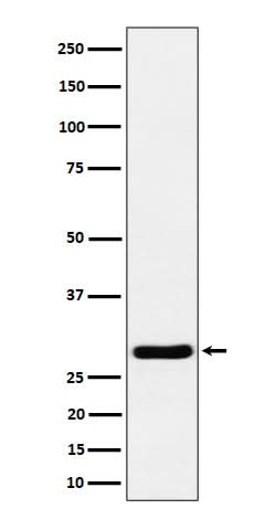 Anti-Calcipressin 1 Rabbit Monoclonal Antibody Boster Bio