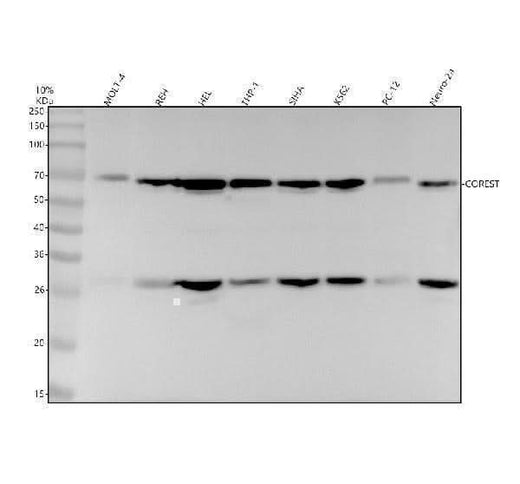 Anti-CoREST Rabbit Monoclonal Antibody Boster Bio