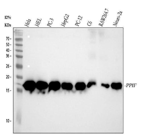 Anti-Cyclophilin F Rabbit Monoclonal Antibody Boster Bio