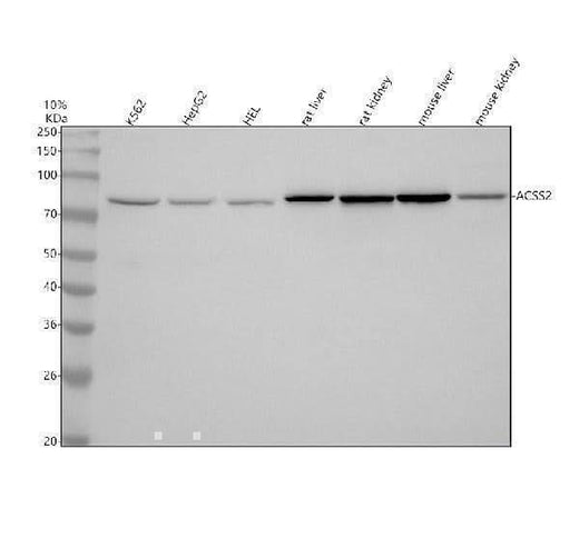 Anti-ACSS2/Acetyl Coa Synthetase Rabbit Monoclonal Antibody Boster Bio