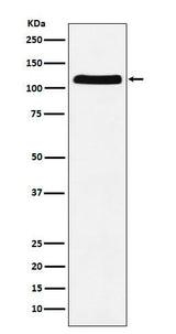 Anti-E1 Ubiquitin Activating Enzyme Rabbit Monoclonal Antibody Boster Bio