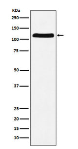 Anti-E1 Ubiquitin Activating Enzyme Rabbit Monoclonal Antibody Boster Bio