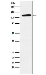 Anti-Eph receptor B1 Rabbit Monoclonal Antibody Boster Bio