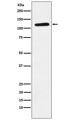 Anti-Eph receptor B1 Rabbit Monoclonal Antibody Boster Bio