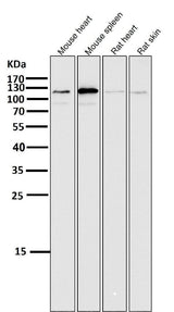 Anti-ERK5 Rabbit Monoclonal Antibody Boster Bio