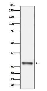 Anti-PNMT Rabbit Monoclonal Antibody Boster Bio