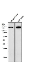 Anti-CNTP2 Rabbit Monoclonal Antibody Boster Bio