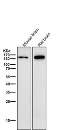 Anti-CNTP2 Rabbit Monoclonal Antibody Boster Bio