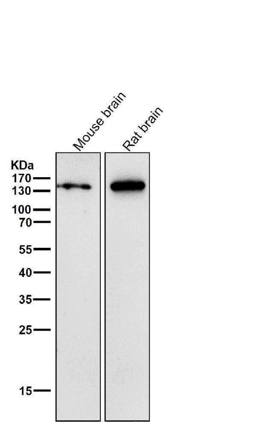 Anti-CNTP2 Rabbit Monoclonal Antibody Boster Bio