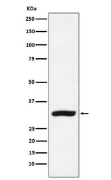 Anti-CBR1 Rabbit Monoclonal Antibody Boster Bio