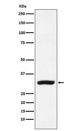 Anti-CBR1 Rabbit Monoclonal Antibody Boster Bio