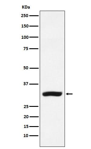 Anti-CBR1 Rabbit Monoclonal Antibody Boster Bio