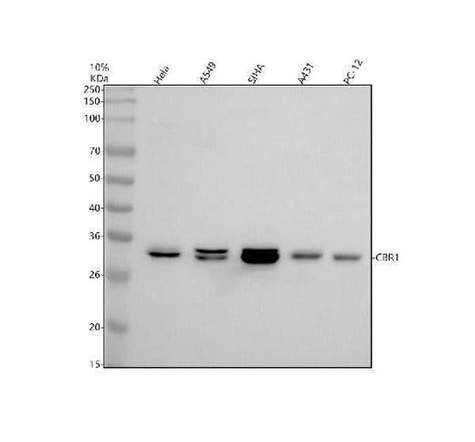 Anti-CBR1 Rabbit Monoclonal Antibody Boster Bio