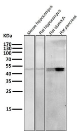 Anti-Cytokeratin 20 KRT20 Rabbit Monoclonal Antibody Boster Bio