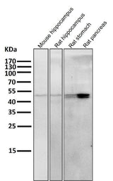 Anti-Cytokeratin 20 KRT20 Rabbit Monoclonal Antibody Boster Bio