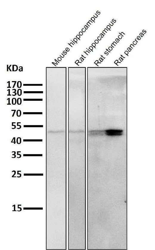 Anti-Cytokeratin 20 KRT20 Rabbit Monoclonal Antibody Boster Bio