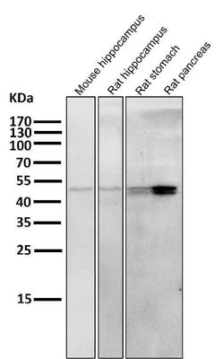 Anti-Cytokeratin 20 KRT20 Rabbit Monoclonal Antibody Boster Bio